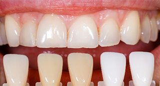 What cosmetic dentistry can do for you