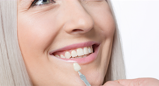 Can Veneers Replace Missing Teeth?